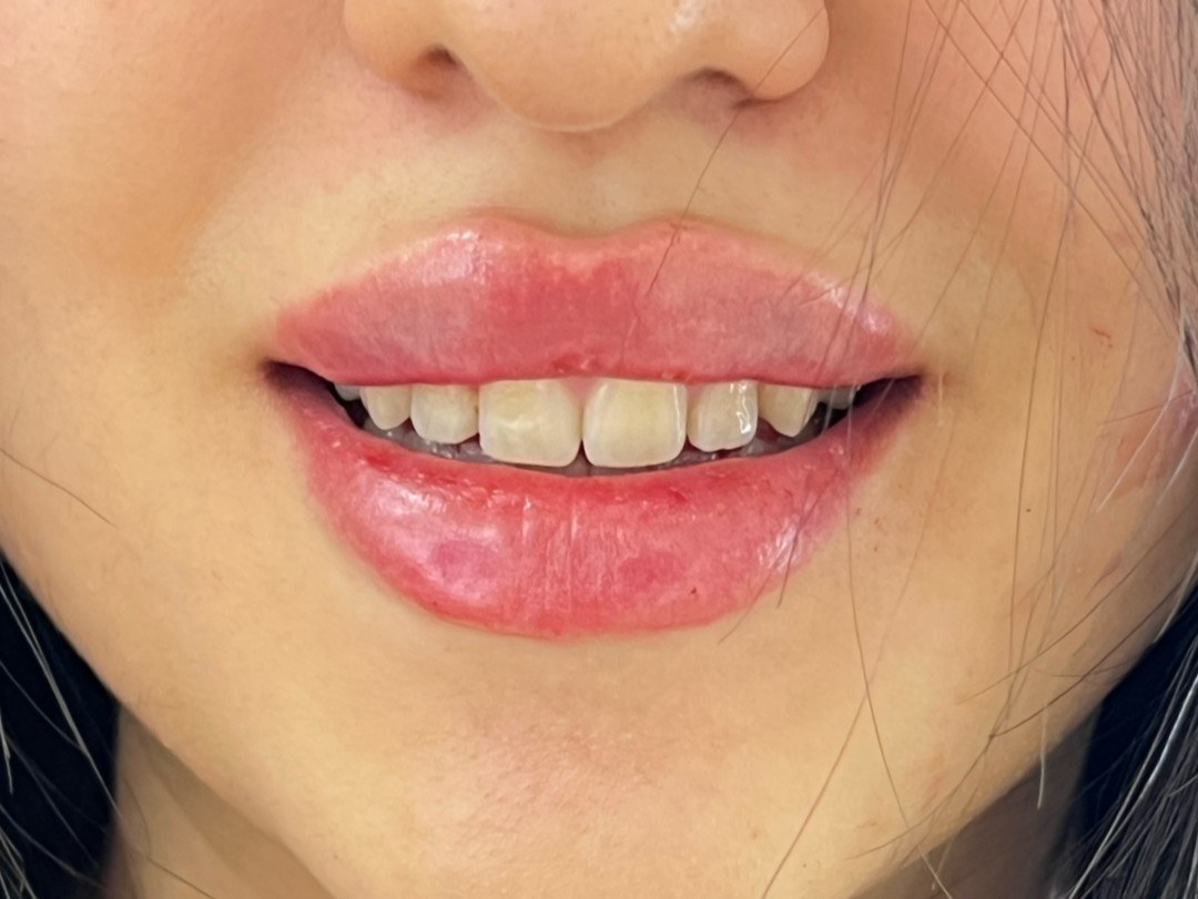 نتيجة علاج في Natour Clinic 2